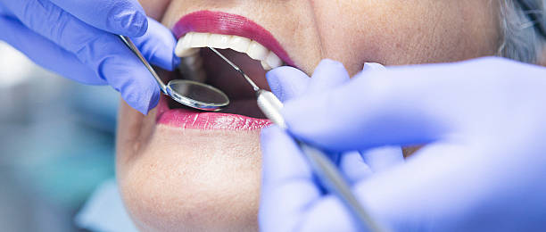 Best Emergency Wisdom Teeth Removal in Reidland, KY